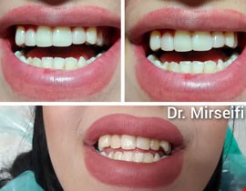 دندان پزشکی تخصصی11