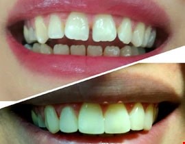دندان پزشکی تخصصی3