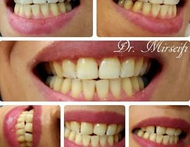 دندان پزشکی تخصصی4