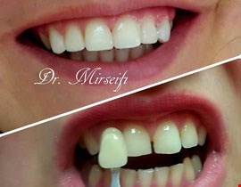 دندان پزشکی تخصصی