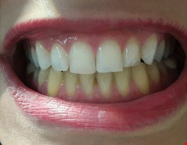 دندان پزشکی تخصصی5